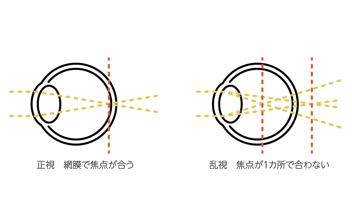 コンタクトレンズの処方箋の見方【保存版】 | パレンテナビ
