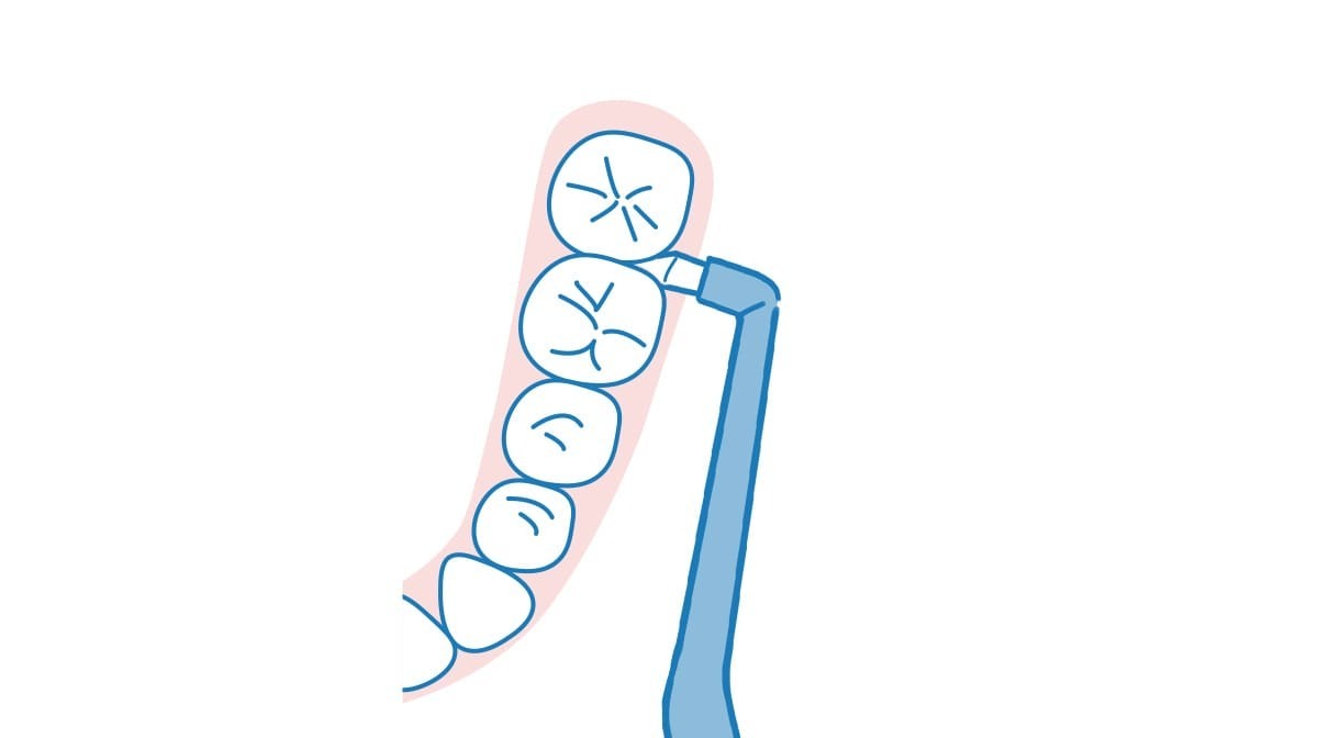 ワンタフトブラシで歯と歯の間を磨くイラスト